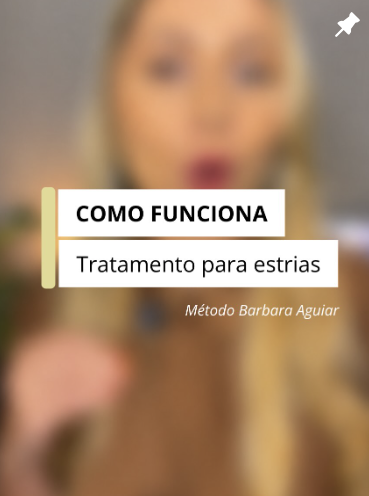 Como funciona o tratamento para estrias — Método Barbara Aguiar